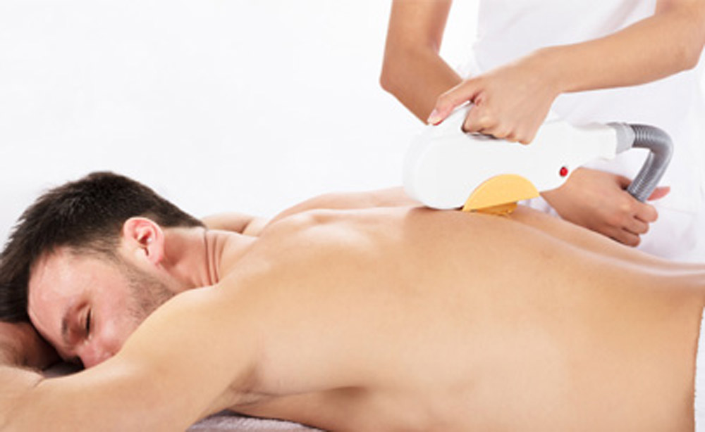 SHR Hair Removal Treatment